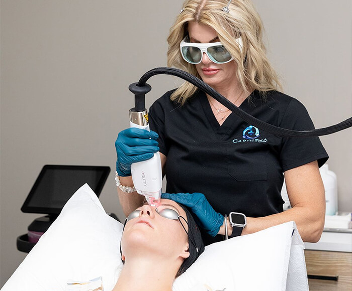 Professional performing ultra skin treatment at Carolina Hormone and Health.